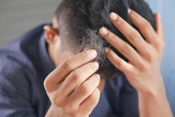 3. Hair Loss Supplements - Let's Take Them Knowingly 1