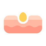 Skin health