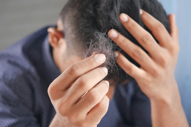 3. Hair Loss Supplements - Let's Take Them Knowingly 1